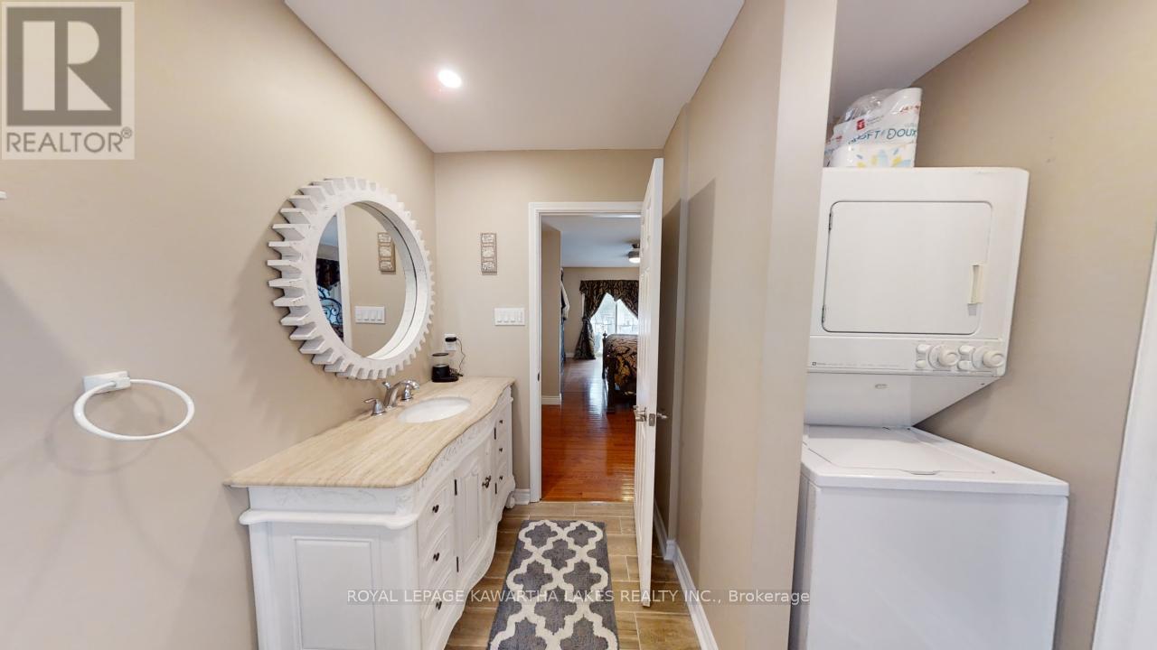 21 Trent View Road, Kawartha Lakes, Ontario  K0M 2B0 - Photo 29 - X11991008